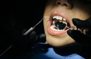 What’s Child’s Overbite & What To Do About It? What's Childs Overbite What To Do About It.