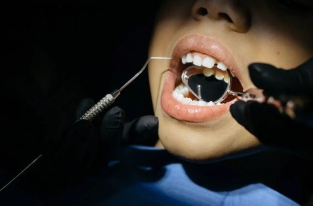 What's Childs Overbite What To Do About It. What's Childs Overbite What To Do About It.